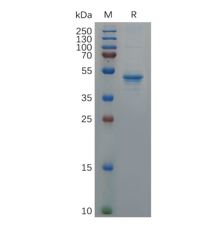 SDS-PAGE - Recombinant Human GDNF Protein (Fc Tag) (A317938) - Antibodies.com