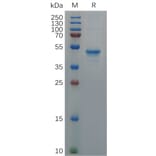 SDS-PAGE - Recombinant Human GDNF Protein (Fc Tag) (A317938) - Antibodies.com