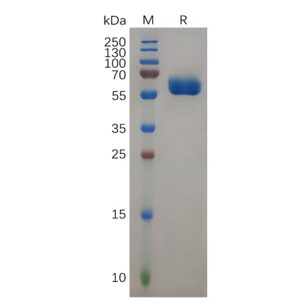 SDS-PAGE - Recombinant Human FOLR2 Protein (Fc Tag) (A317939) - Antibodies.com