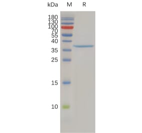 SDS-PAGE - Recombinant Human Claudin 3 Protein (Fc Tag) (A317941) - Antibodies.com
