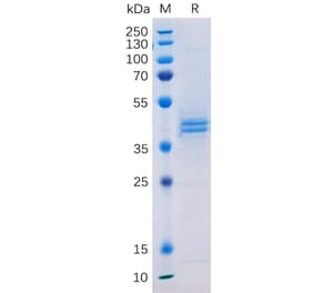 SDS-PAGE - Recombinant Human CD133 Protein (Fc Tag) (A317943) - Antibodies.com