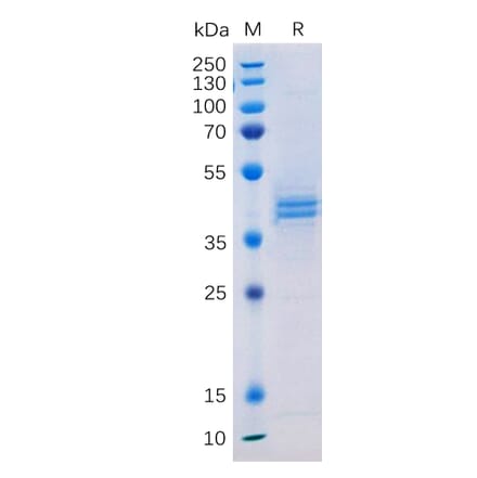 SDS-PAGE - Recombinant Human CD133 Protein (Fc Tag) (A317943) - Antibodies.com