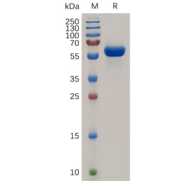 SDS-PAGE - Recombinant Human RANK Protein (Fc Tag) (A317946) - Antibodies.com