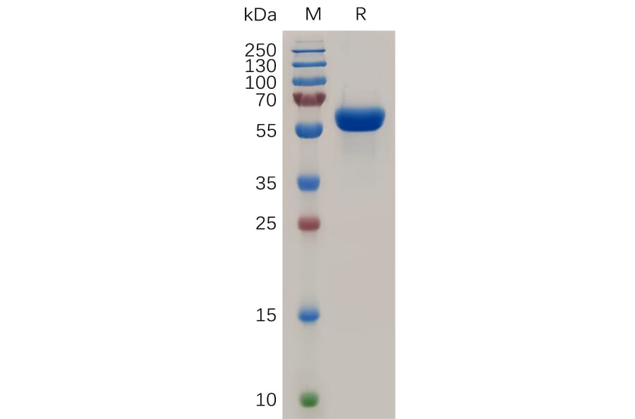 SDS-PAGE - Recombinant Human RANK Protein (Fc Tag) (A317946) - Antibodies.com