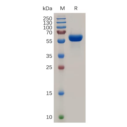 SDS-PAGE - Recombinant Human RANK Protein (Fc Tag) (A317946) - Antibodies.com