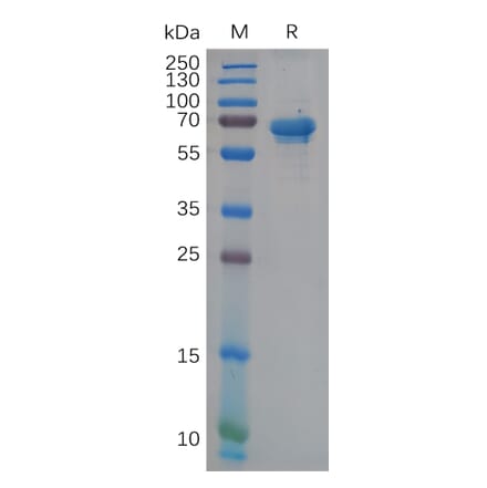 SDS-PAGE - Recombinant Human NCR1 Protein (Fc Tag) (A317947) - Antibodies.com
