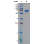 SDS-PAGE - Recombinant Human NCR1 Protein (Fc Tag) (A317947) - Antibodies.com