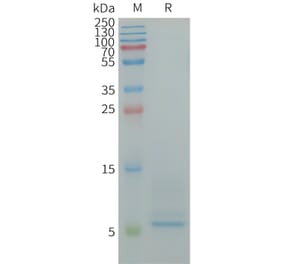 SDS-PAGE - Recombinant Human CD9 Protein (6×His Tag) (A317949) - Antibodies.com