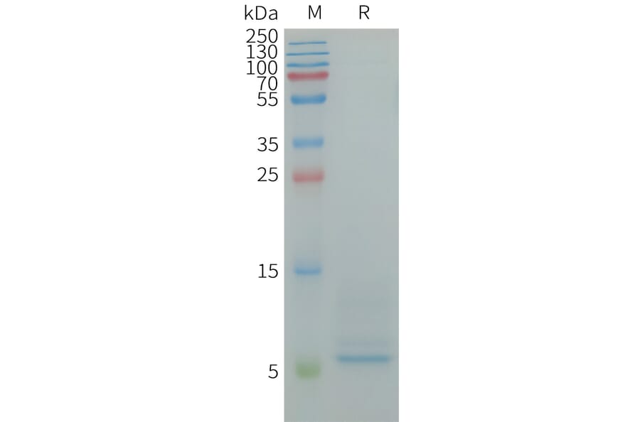 SDS-PAGE - Recombinant Human CD9 Protein (6×His Tag) (A317949) - Antibodies.com