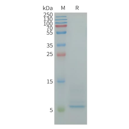 SDS-PAGE - Recombinant Human CD9 Protein (6×His Tag) (A317949) - Antibodies.com