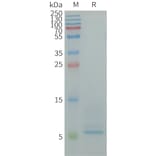 SDS-PAGE - Recombinant Human CD9 Protein (6×His Tag) (A317949) - Antibodies.com