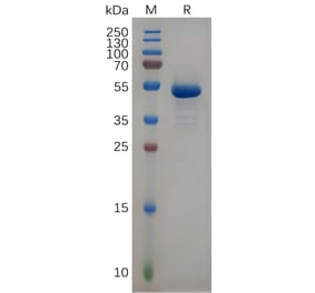 SDS-PAGE - Recombinant Human CD99 Protein (Fc Tag) (A317950) - Antibodies.com