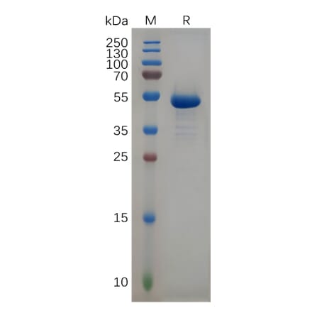 SDS-PAGE - Recombinant Human CD99 Protein (Fc Tag) (A317950) - Antibodies.com