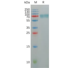 SDS-PAGE - Recombinant Human KIR2DL2 Protein (Fc Tag) (A317951) - Antibodies.com