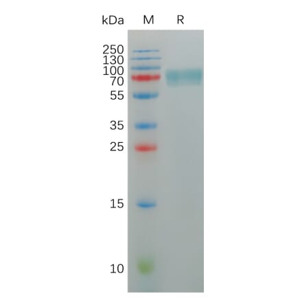 SDS-PAGE - Recombinant Human KIR2DL2 Protein (Fc Tag) (A317951) - Antibodies.com