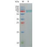 SDS-PAGE - Recombinant Human KIR2DL2 Protein (Fc Tag) (A317951) - Antibodies.com