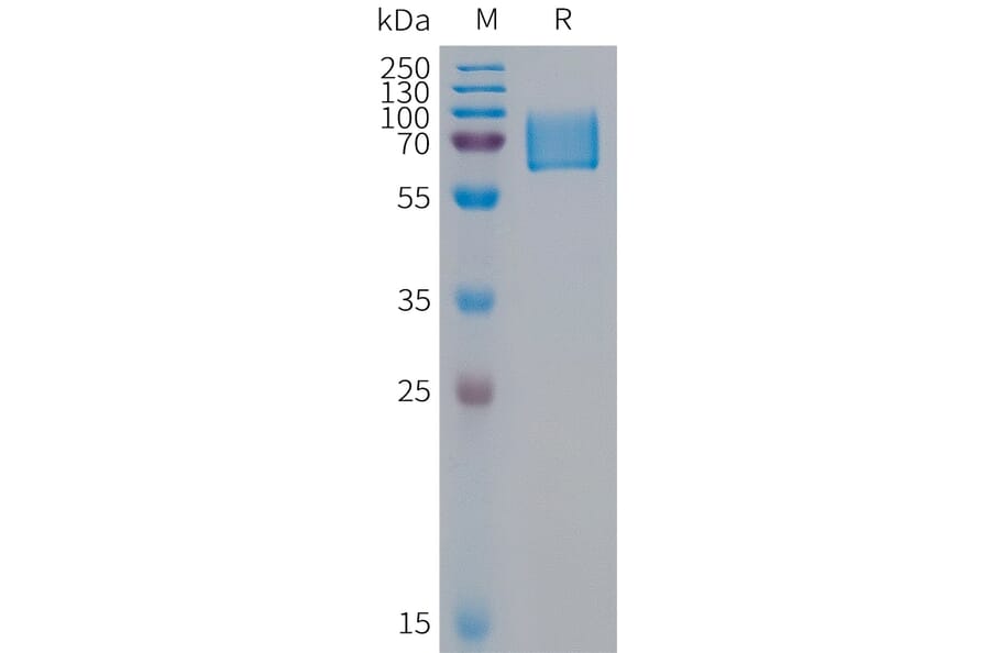SDS-PAGE - Recombinant Human KIR2DL1 Protein (Fc Tag) (A317952) - Antibodies.com