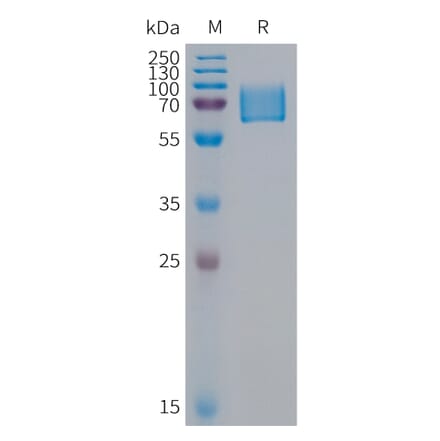 SDS-PAGE - Recombinant Human KIR2DL1 Protein (Fc Tag) (A317952) - Antibodies.com