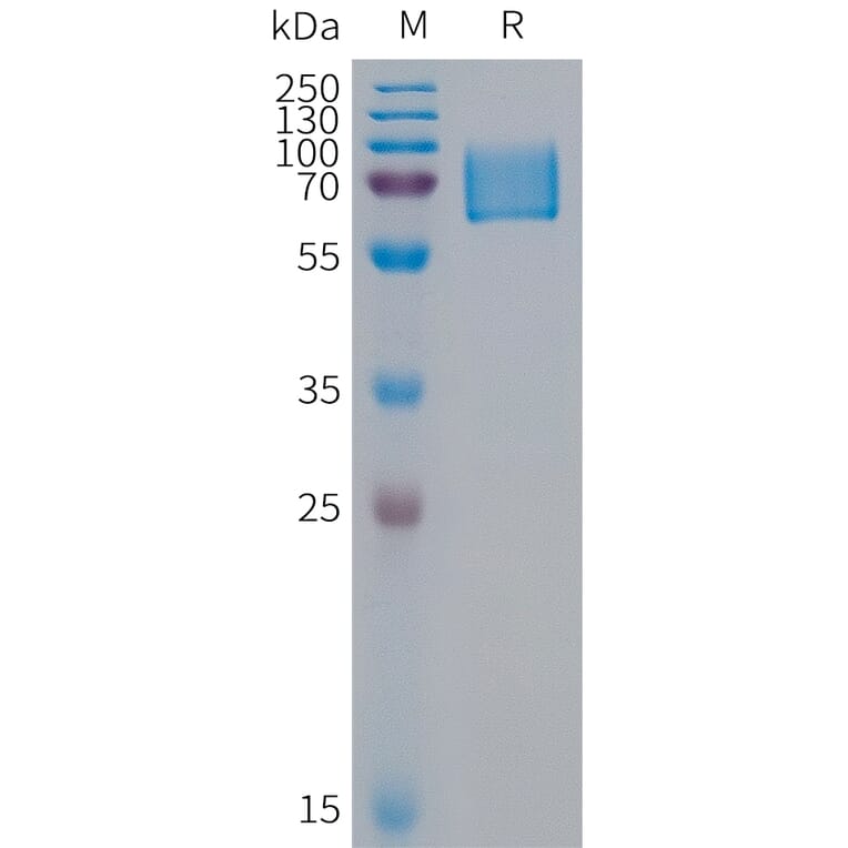 SDS-PAGE - Recombinant Human KIR2DL1 Protein (Fc Tag) (A317952) - Antibodies.com