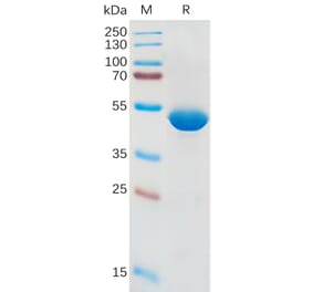 SDS-PAGE - Recombinant Human IL-1 beta Protein (Fc Tag) (A317954) - Antibodies.com