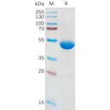 SDS-PAGE - Recombinant Human IL-1 beta Protein (Fc Tag) (A317954) - Antibodies.com