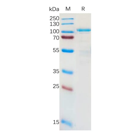 SDS-PAGE - Recombinant Human LRRC32 Protein (Fc Tag) (A317955) - Antibodies.com