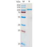 SDS-PAGE - Recombinant Human LRRC32 Protein (Fc Tag) (A317955) - Antibodies.com
