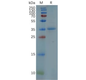 SDS-PAGE - Recombinant Human CXCR5 Protein (Fc Tag) (A317956) - Antibodies.com