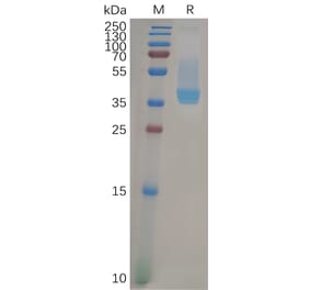SDS-PAGE - Recombinant Human CXCR4 Protein (Fc Tag) (A317957) - Antibodies.com