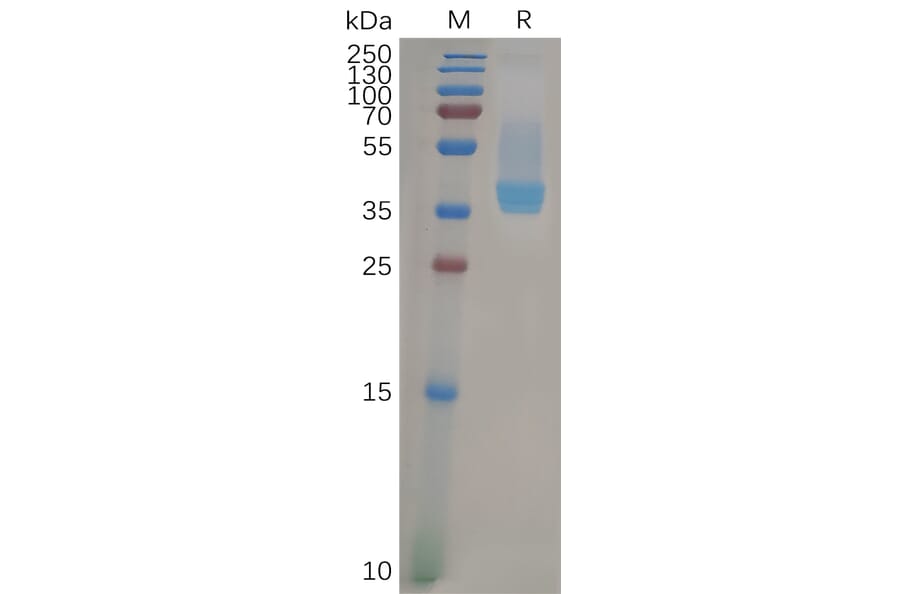 SDS-PAGE - Recombinant Human CXCR4 Protein (Fc Tag) (A317957) - Antibodies.com