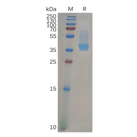 SDS-PAGE - Recombinant Human CXCR4 Protein (Fc Tag) (A317957) - Antibodies.com