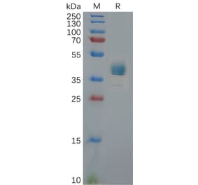 SDS-PAGE - Recombinant Human CXCR3 Protein (Fc Tag) (A317958) - Antibodies.com
