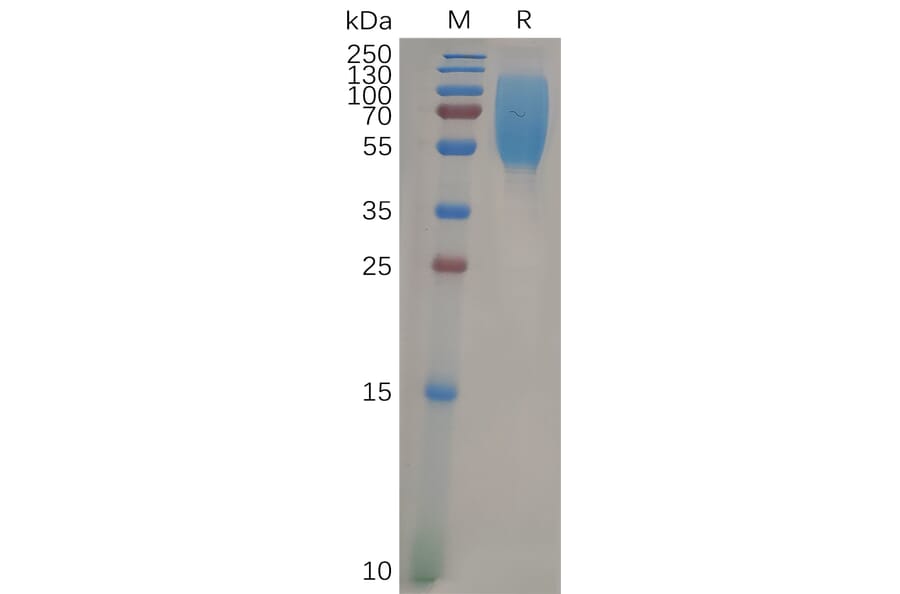 SDS-PAGE - Recombinant Human CEACAM1 Protein (6×His Tag) (A317960) - Antibodies.com