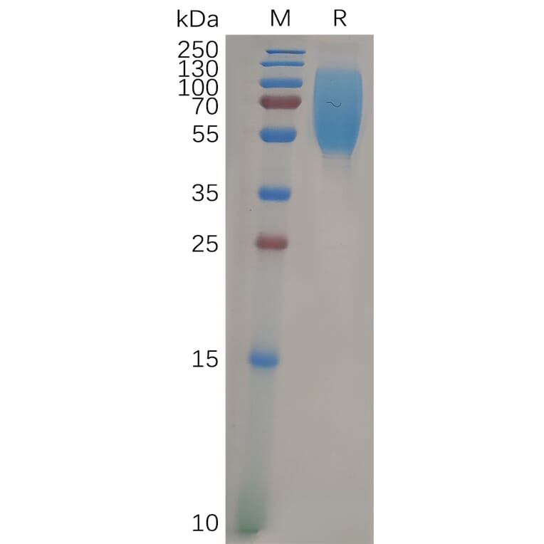 SDS-PAGE - Recombinant Human CEACAM1 Protein (6×His Tag) (A317960) - Antibodies.com
