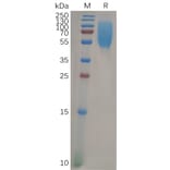 SDS-PAGE - Recombinant Human CEACAM1 Protein (6×His Tag) (A317960) - Antibodies.com