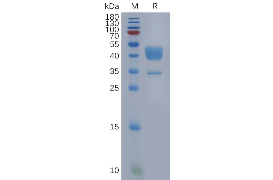 SDS-PAGE - Recombinant Human C5a-R Protein (Fc Tag) (A317961) - Antibodies.com