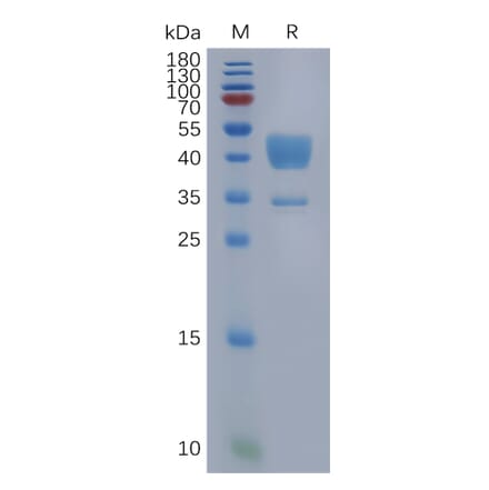 SDS-PAGE - Recombinant Human C5a-R Protein (Fc Tag) (A317961) - Antibodies.com