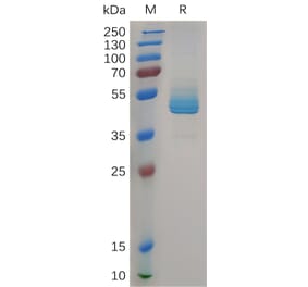 SDS-PAGE - Recombinant Human CD3 epsilon Protein (Fc Tag) (A317963) - Antibodies.com