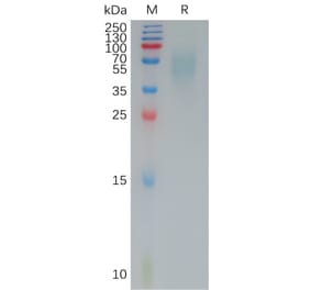 SDS-PAGE - Recombinant Human CD200R Protein (6×His Tag) (A317964) - Antibodies.com