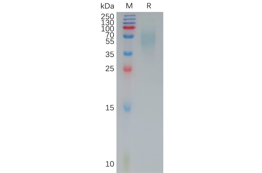 SDS-PAGE - Recombinant Human CD200R Protein (6×His Tag) (A317964) - Antibodies.com