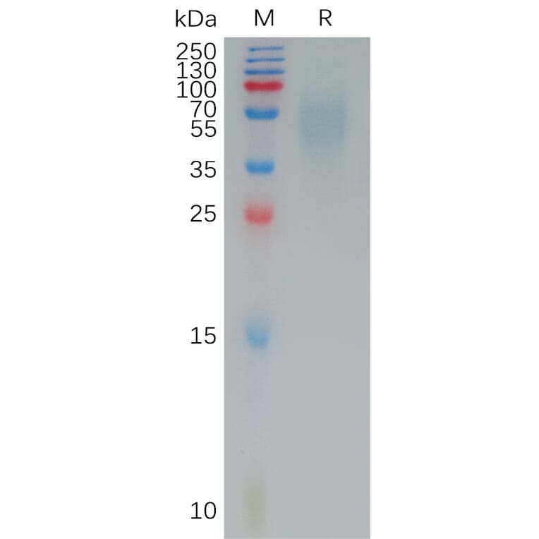 SDS-PAGE - Recombinant Human CD200R Protein (6×His Tag) (A317964) - Antibodies.com