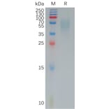 SDS-PAGE - Recombinant Human CD200R Protein (6×His Tag) (A317964) - Antibodies.com