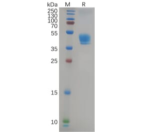 SDS-PAGE - Recombinant Human CCR9 Protein (Fc Tag) (A317965) - Antibodies.com