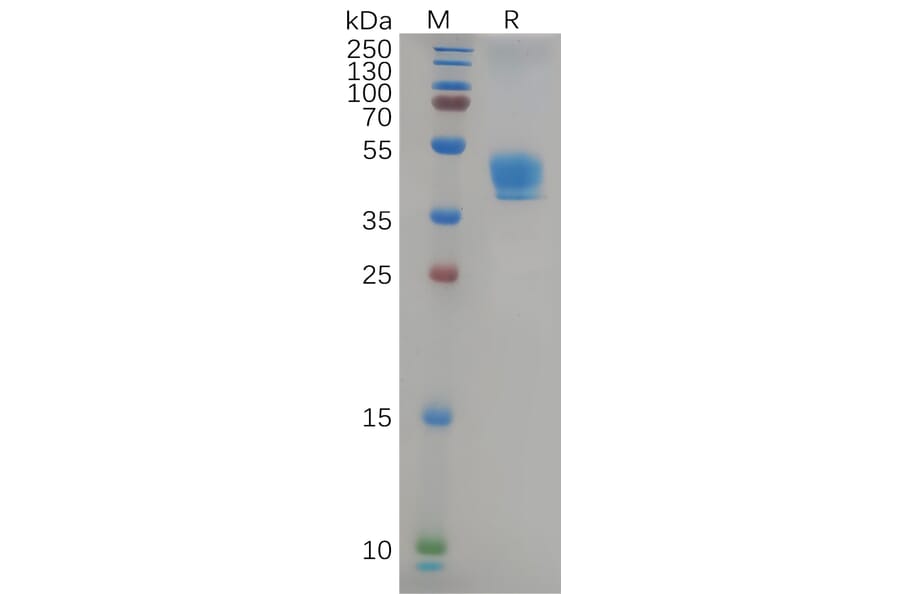 SDS-PAGE - Recombinant Human CCR9 Protein (Fc Tag) (A317965) - Antibodies.com