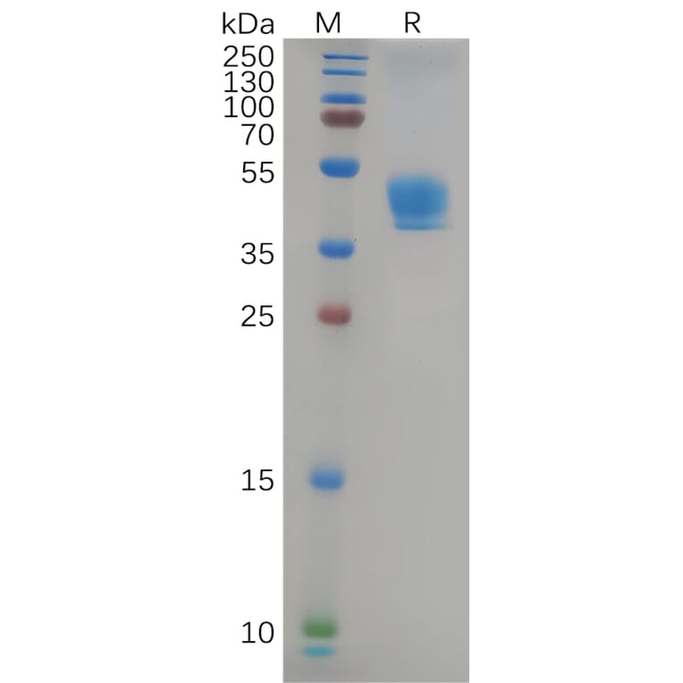 SDS-PAGE - Recombinant Human CCR9 Protein (Fc Tag) (A317965) - Antibodies.com