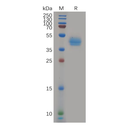 SDS-PAGE - Recombinant Human CCR7 Protein (Fc Tag) (A317966) - Antibodies.com