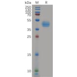 SDS-PAGE - Recombinant Human CCR7 Protein (Fc Tag) (A317966) - Antibodies.com