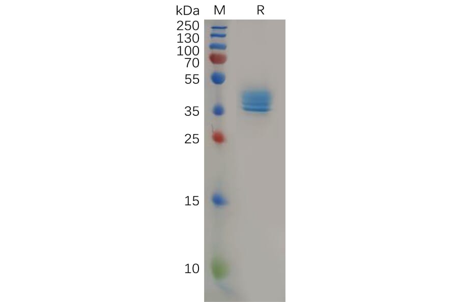 SDS-PAGE - Recombinant Human CCR4 Protein (Fc Tag) (A317967) - Antibodies.com