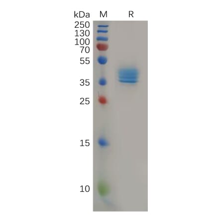 SDS-PAGE - Recombinant Human CCR4 Protein (Fc Tag) (A317967) - Antibodies.com