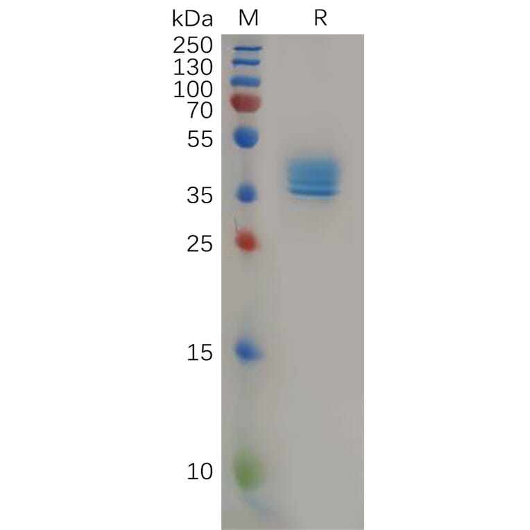 SDS-PAGE - Recombinant Human CCR4 Protein (Fc Tag) (A317967) - Antibodies.com